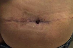 12202032_1191070514242136_1052165871_n crop